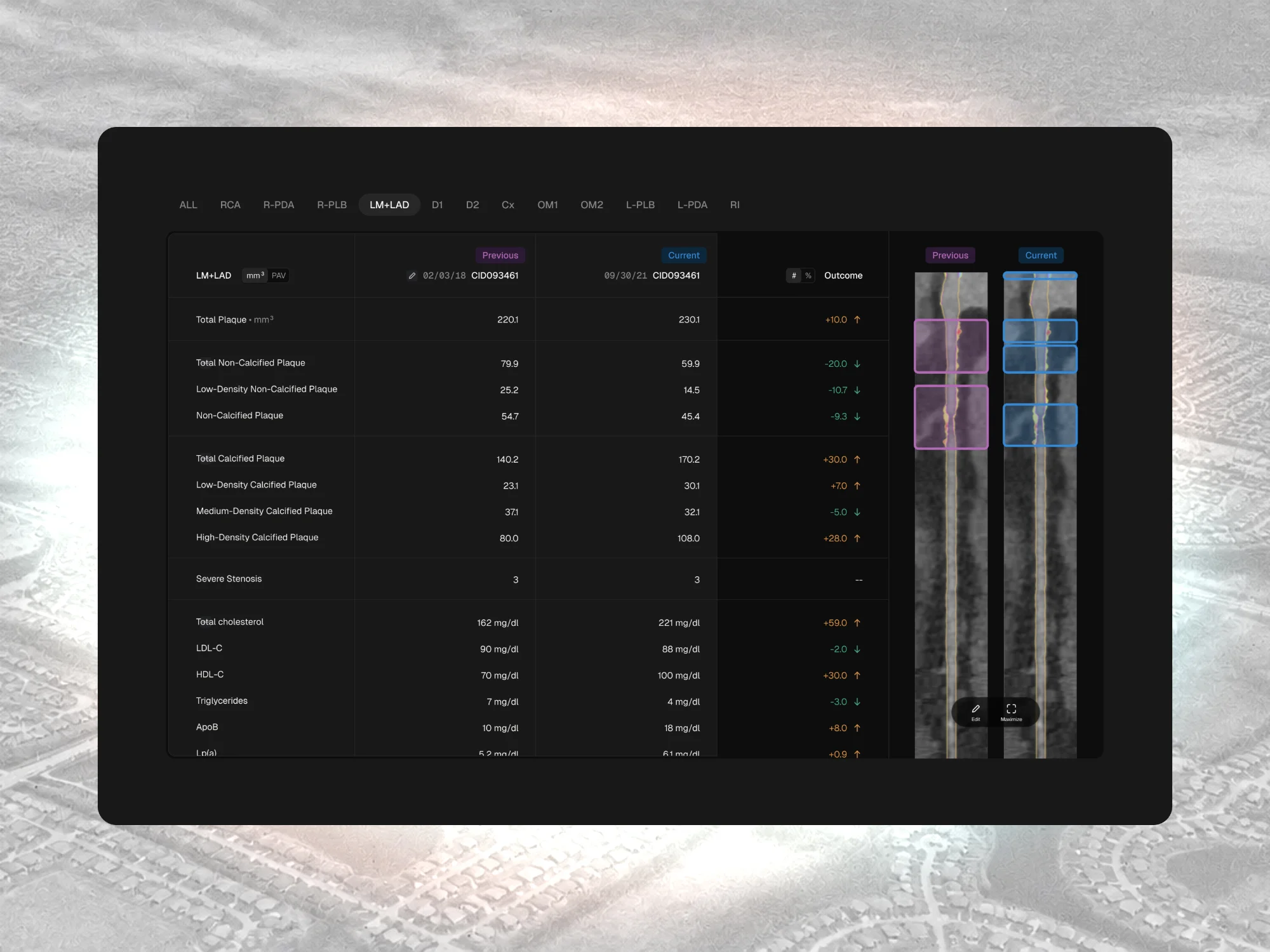 Dark medtech dashboard comparing clinical values side by side with scan images.